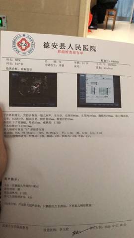 journal_insert_pic_1673084826