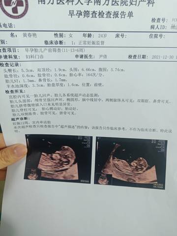 journal_insert_pic_1689158888