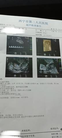 journal_insert_pic_1677082216