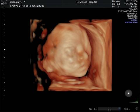 journal_insert_pic_1677012256