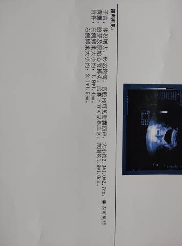 journal_insert_pic_1685504461
