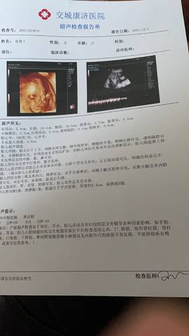 journal_insert_pic_1682235028