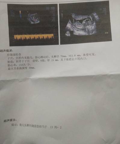 journal_insert_pic_1687259821