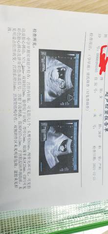 journal_insert_pic_1683707686