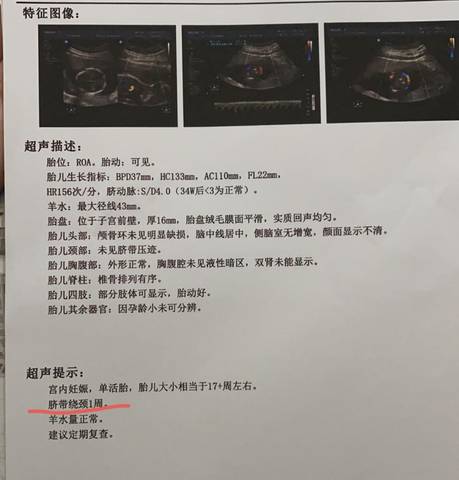 journal_insert_pic_1675290786