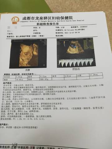 journal_insert_pic_1687390963