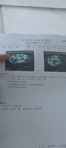 journal_insert_pic_1674664099