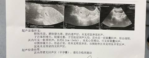journal_insert_pic_1740806122