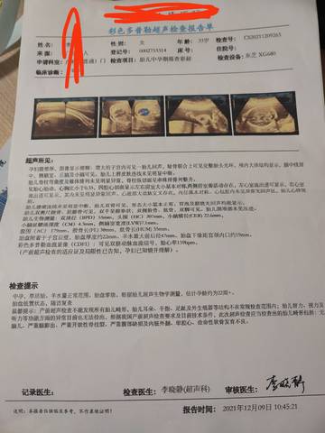 journal_insert_pic_1677355670