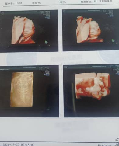 journal_insert_pic_1684213518