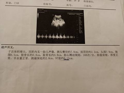 journal_insert_pic_1682751536