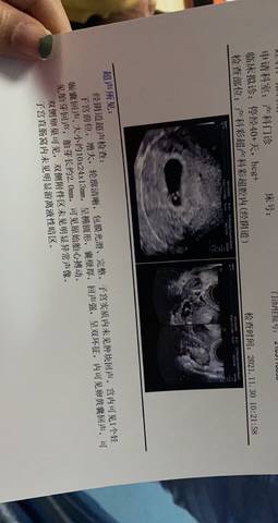 journal_insert_pic_1674855227