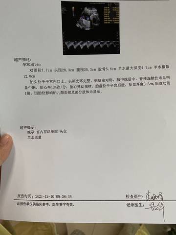 journal_insert_pic_1680007260