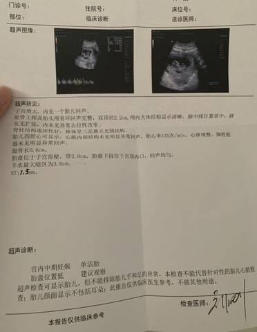 journal_insert_pic_1682129752