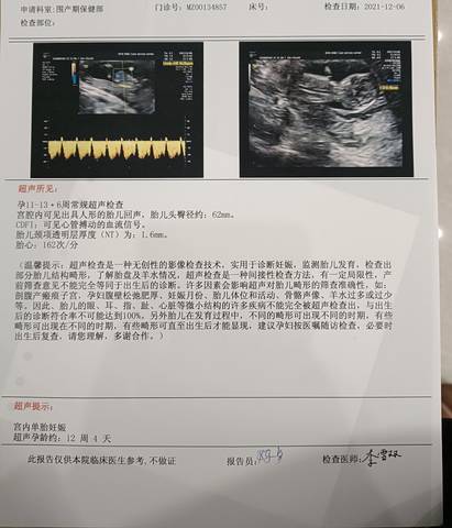 journal_insert_pic_1675419126