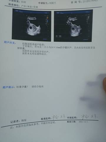 journal_insert_pic_1675676789