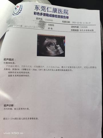 journal_insert_pic_1674200279