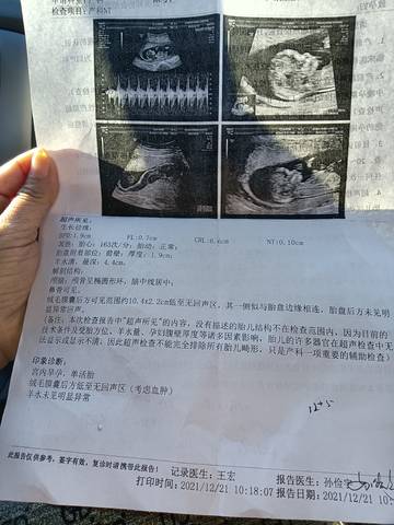 journal_insert_pic_1684042634