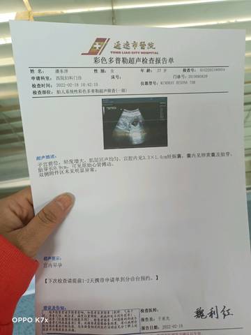 journal_insert_pic_1719433572