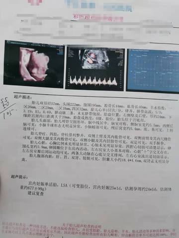 journal_insert_pic_1681633735