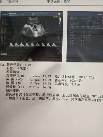 journal_insert_pic_1741084319