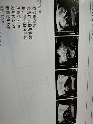 journal_insert_pic_1674740031