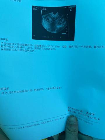 journal_insert_pic_1679568317