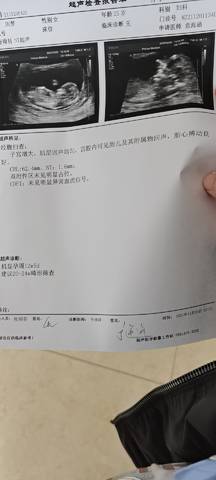 journal_insert_pic_1683436548