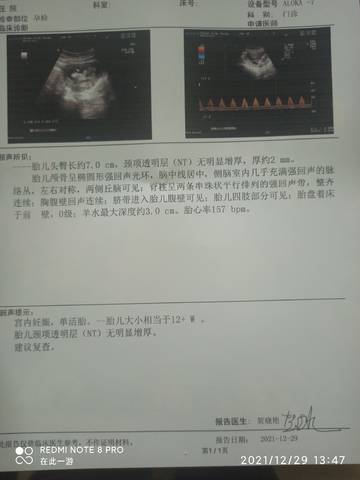 journal_insert_pic_1688302621