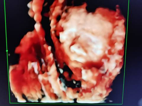 journal_insert_pic_1684206124