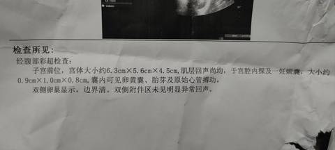 journal_insert_pic_1687906525