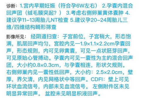 journal_insert_pic_1685490406