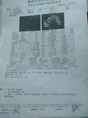 journal_insert_pic_1741009108