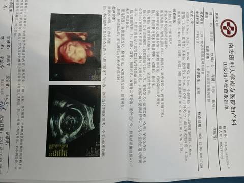 journal_insert_pic_1674697753