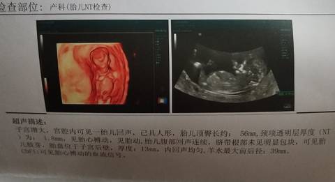 journal_insert_pic_1719616271