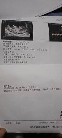 journal_insert_pic_1682048822