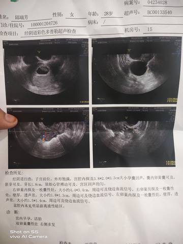 journal_insert_pic_1673316518