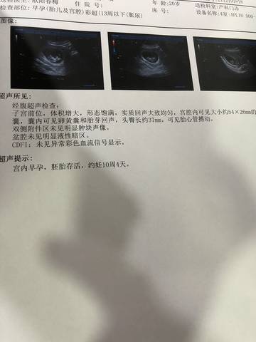 journal_insert_pic_1682566876