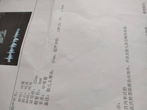 journal_insert_pic_1740977906