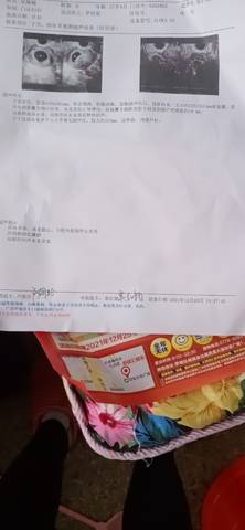 journal_insert_pic_1688272974