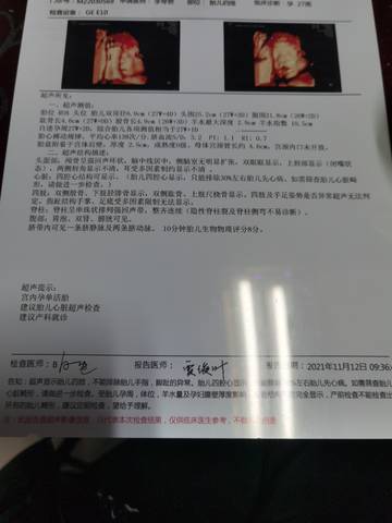 journal_insert_pic_1673290489