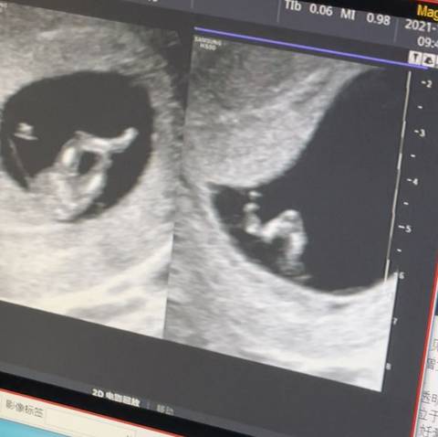 journal_insert_pic_1676707317