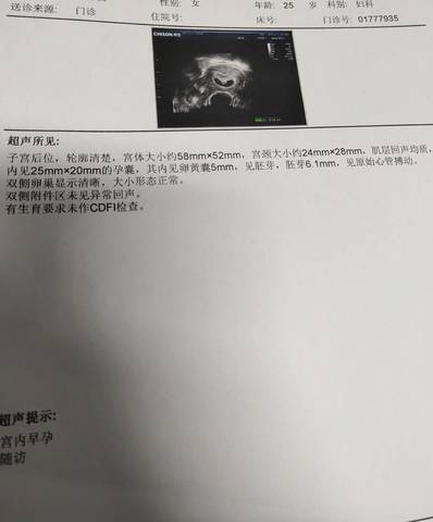 journal_insert_pic_1683664522