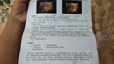 journal_insert_pic_1689396300