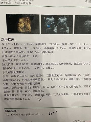journal_insert_pic_1741127144