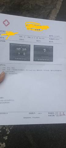 journal_insert_pic_1682064650