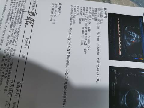 journal_insert_pic_1684811094