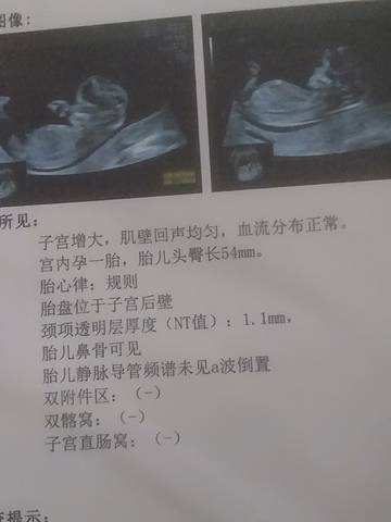 journal_insert_pic_1684292478