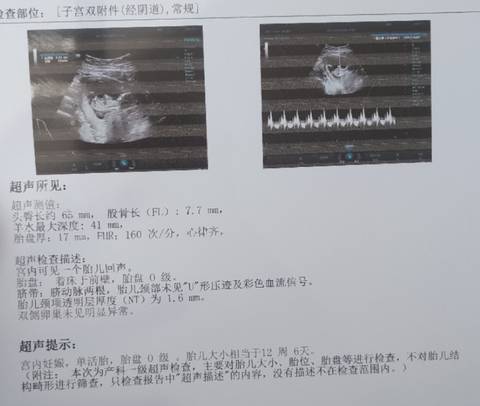 journal_insert_pic_1684599904