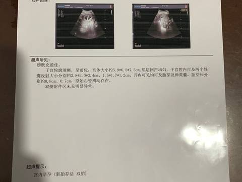 journal_insert_pic_1682120316